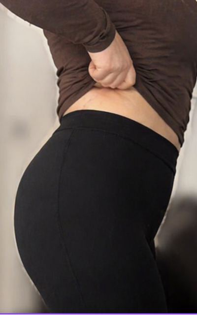 Customer success After image